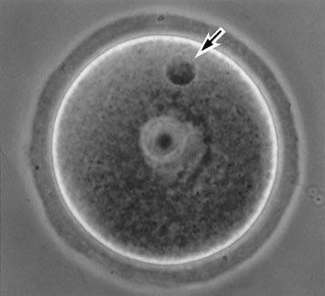 When Met I oocytes were used for microfertilization (Method B), GV oocytes collected from the ovaries were cultured in MEM- medium for 4 hr (until prometaphase I).