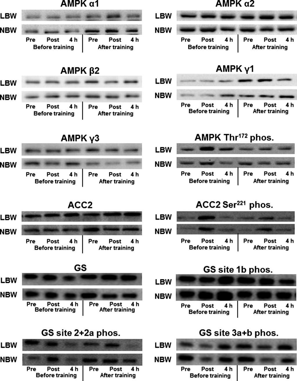 E1384 Fig. 2. Representative blots. Examples of representative Western blots shown for acute exercise effects, group effects, and training effects for AMPK-, ACC2-, and GS-derived measurements.