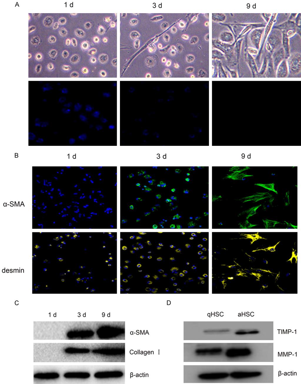 Figure 2. Induction of MMP-1 during HSC differentiation in vitro. Freshly isolated rat HSC after recovery for two to three days still retain some features of a quiescent phenotype.