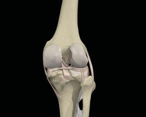 Collateral Ligament MCL PCL (Posterior View) LCL Center of Rotation Lateral Impact ACL/PCL elongations are sensitive to