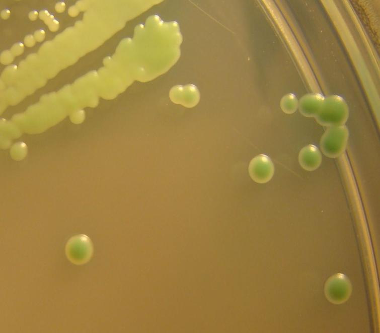 Sample 2/2010 Candida albicans Strain identification on a chromogenic agar plate: Chromagar Candida