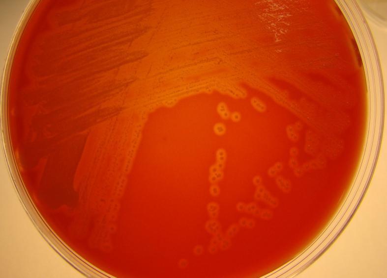 Sample 2/2010 Pus from an infected axillary eczema Growth on sheep blood agar plate in 5% CO 2 at +35 C, after 24 and 48