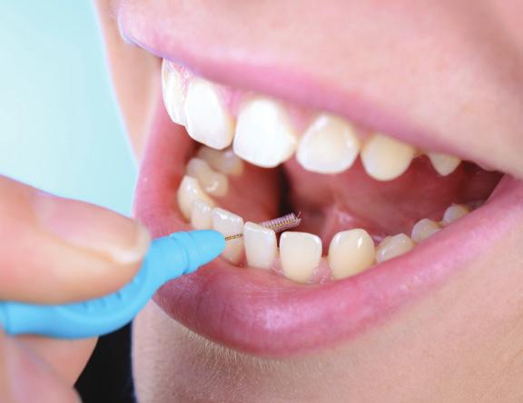 Corrective (surgical) treatment Sometimes, a surgical procedure is carried out to clean away plaque bacteria and deposits that are under the gum within periodontal pockets and on the root surfaces.