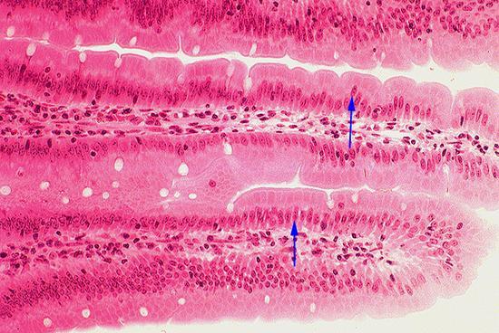 Simple Columnar Pseudostratified Epithelium Pseudostratified epithelium: appears to have several layers because the nuclei are at various levels.