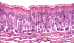 Pseudostratified Stratified Epithelium Epithelia have at least two layers of cells.