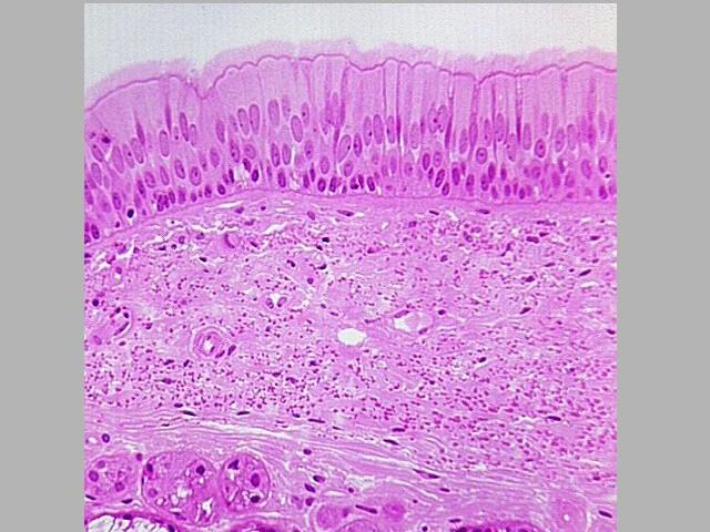 Pseudostratified Epithelial Tissues 2. Cell Shape a. flat or squamous b.