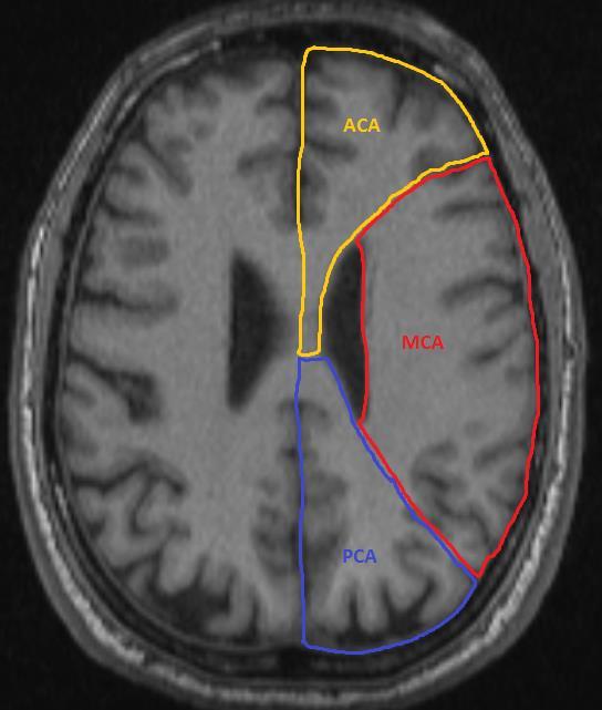 LOCATION Posterior Cerebral Artery Visual deficits, often homonymous hemianopsia