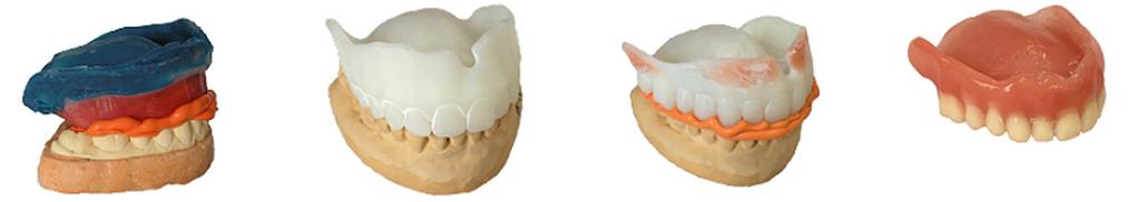 Raise the bite with Articulator and remove teeth directly in Full Dentures Smile Composer.