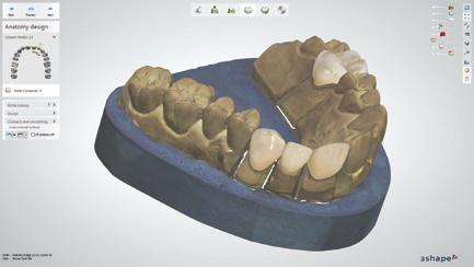 package gives your dental lab