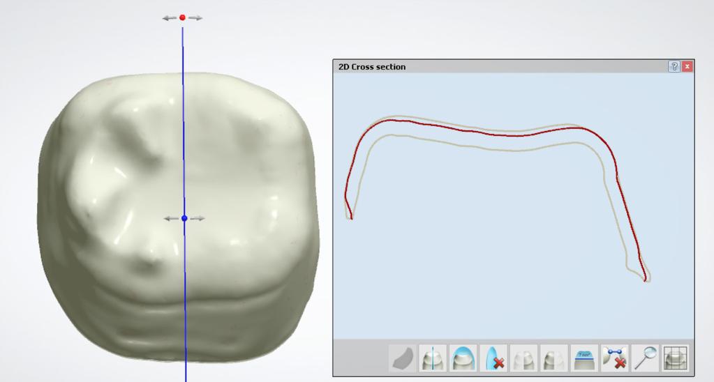 Distance to adjacent measurement tool now works only with designed teeth and together with Distance to preparation