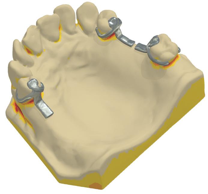 The option is controlled at the Frames page in Dental System Control Panel.