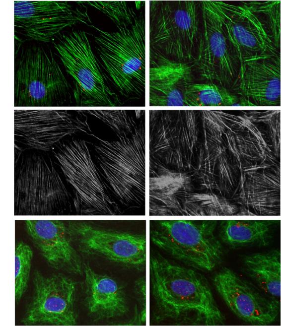 KD of plastin 3 leads to disorganization of actin microfilaments in Sertoli cells.