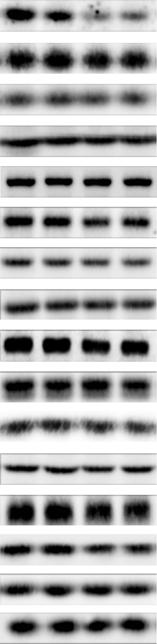453 394 298 TJ protein Basal ES protein Actin regulatory protein Hemidesmosome protein Cytoskeletal protein Relative plastin 3 protein level (Arbitrary unit).5. Marker sirna sirna, 53 bp Plastin, 88