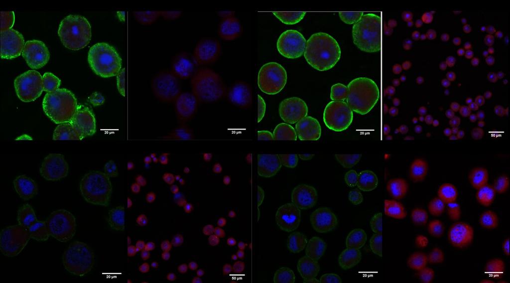 Figure 11: Confocal microscopy of cells infected with modified viruses shows that CuZnSOD is overexpressed in czsod and CHC- infected cells and not in cells infected with Wt-AcMNPV or in uninfected