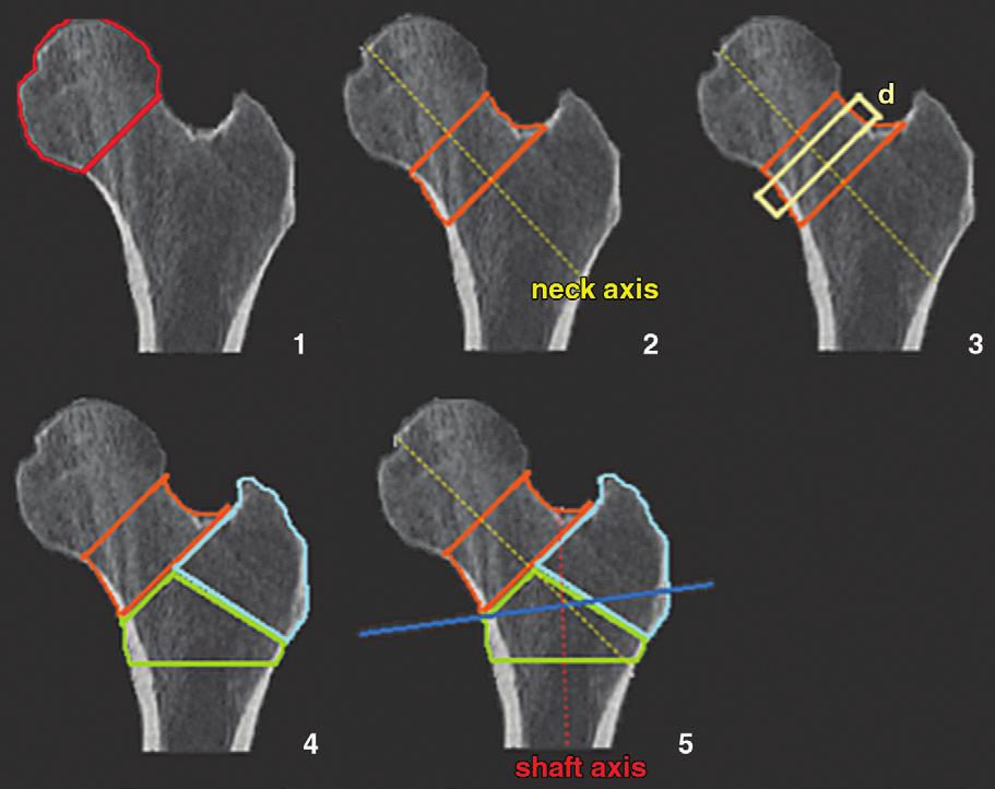 Figure 4 Figure 4: Representation of the VOIs determined with the aforementioned imaging software.