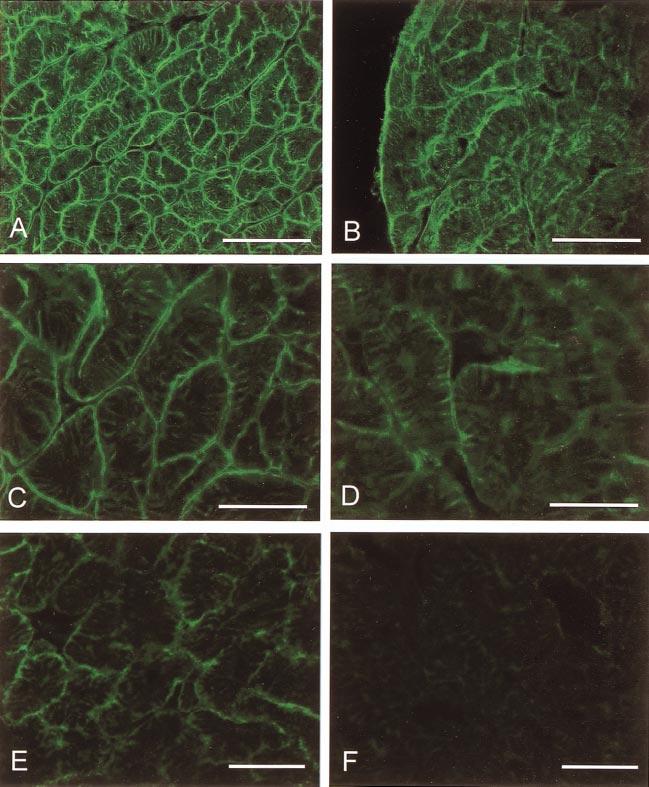 The absence of dystrophin and -dystroglycan immunolabeling in type A- positive EBD-stained areas in which WGA staining of membrane lipid and glycoproteins were preserved is consistent with increased