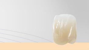 (ZrO 2 ) ceramics for restorations ranging from thin veneers to long-span bridges Flexibility of cementation: adhesive, self-adhesive and