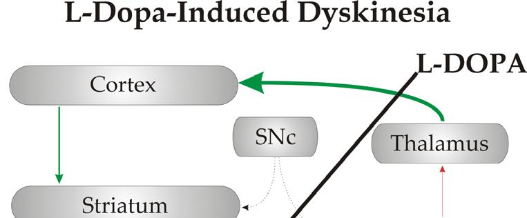 Figure 17 Aberrant Plasticity in L-Dopa-induced dyskinesia.