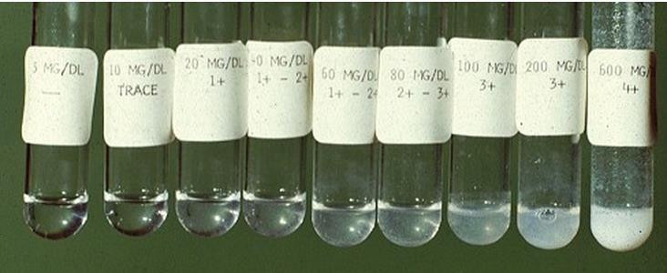 - Sulfosalicylic acid (SSA) test: The sulfosalicylic acid (SSA) turbidity test quantitatively screens for proteinuria.