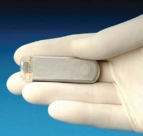 What is an Implantable Loop Recorder (ILR)? An Implantable Loop Recorder (ILR) is a small thin device that is inserted under the skin to record the activity of your heart.