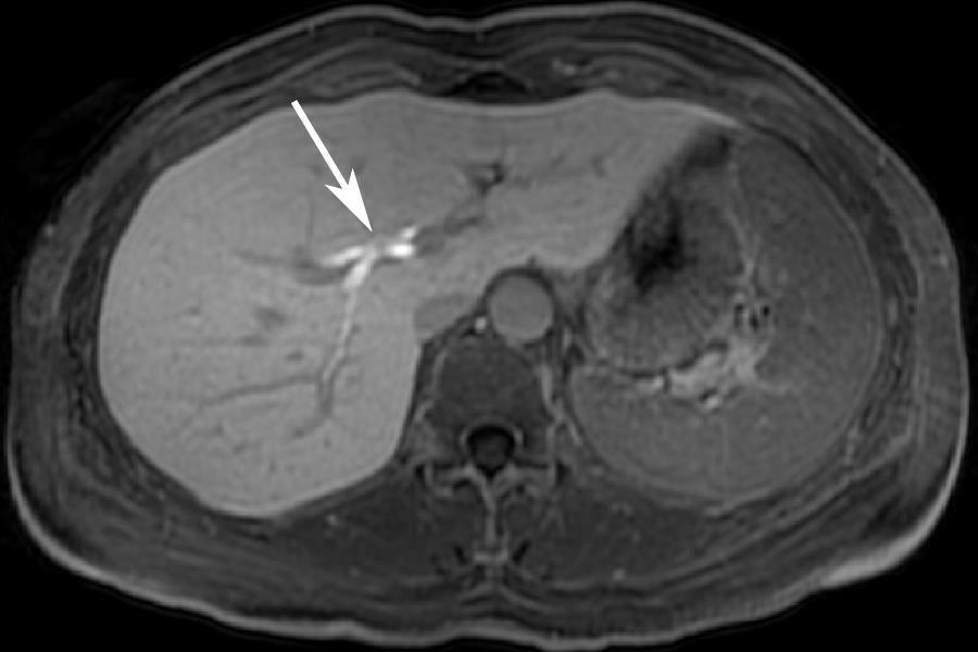 Hepatobiliary Dynamic Imaging of of the the Liver Liver