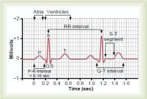 Automatic Detection of Abnormalities in ECG Signals : A MATLAB Study M. Hamiane, I. Y.