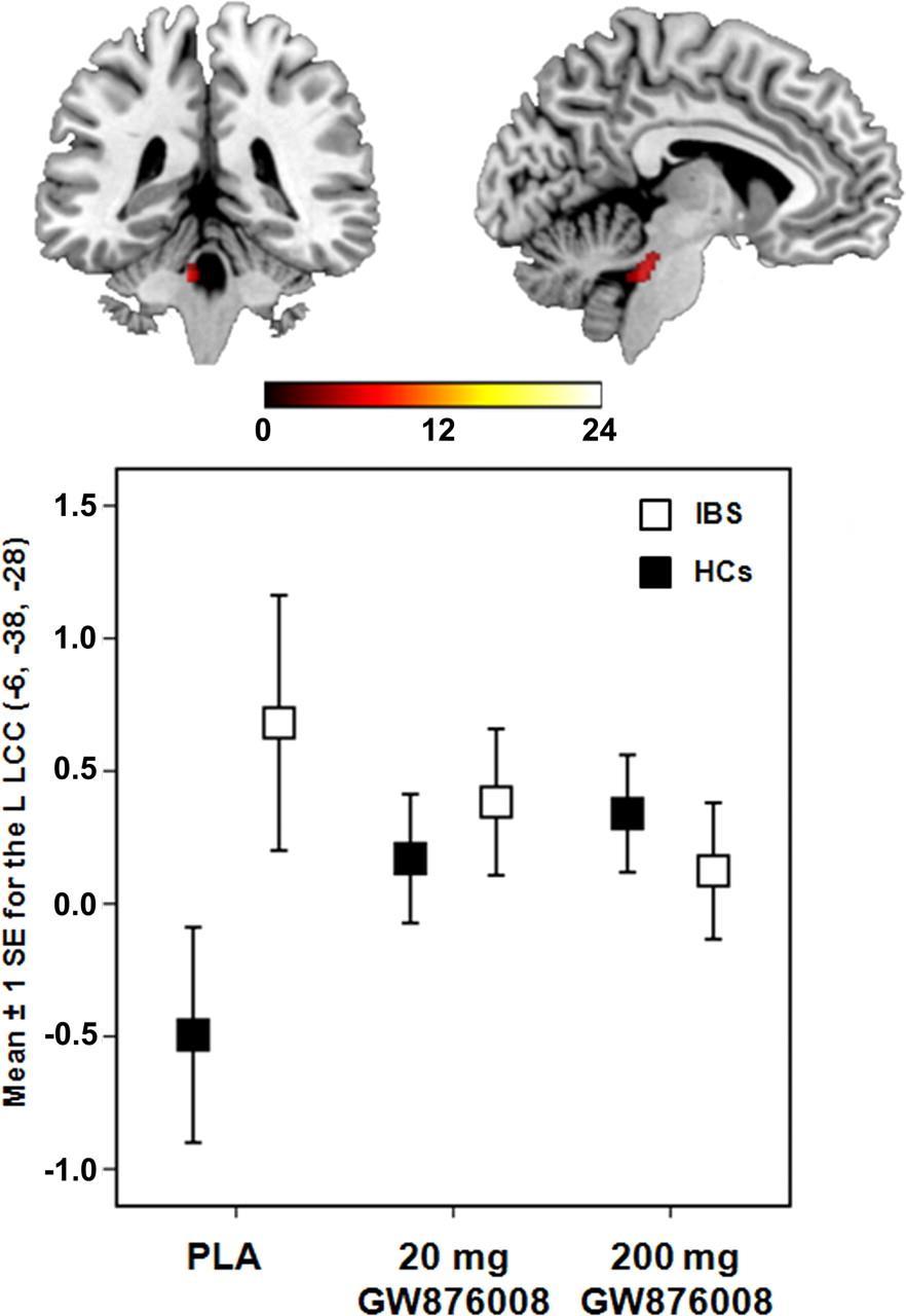 Brain responses to anticipation of visceral pain role of CRF