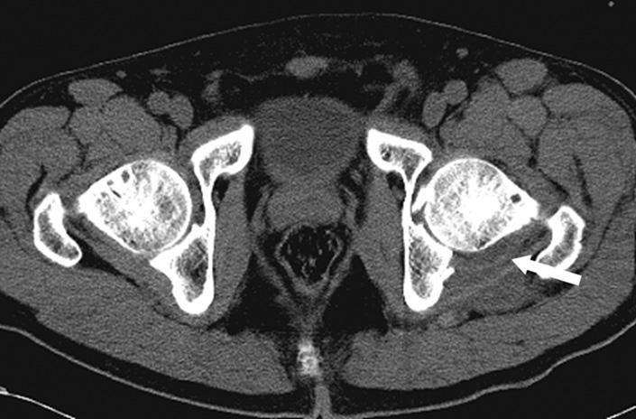 The coronal and sagittal reformatted images were produced from nine CT scans.