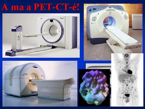 PET/CT (positron emission