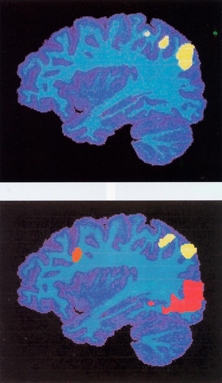 Mapping of brain function