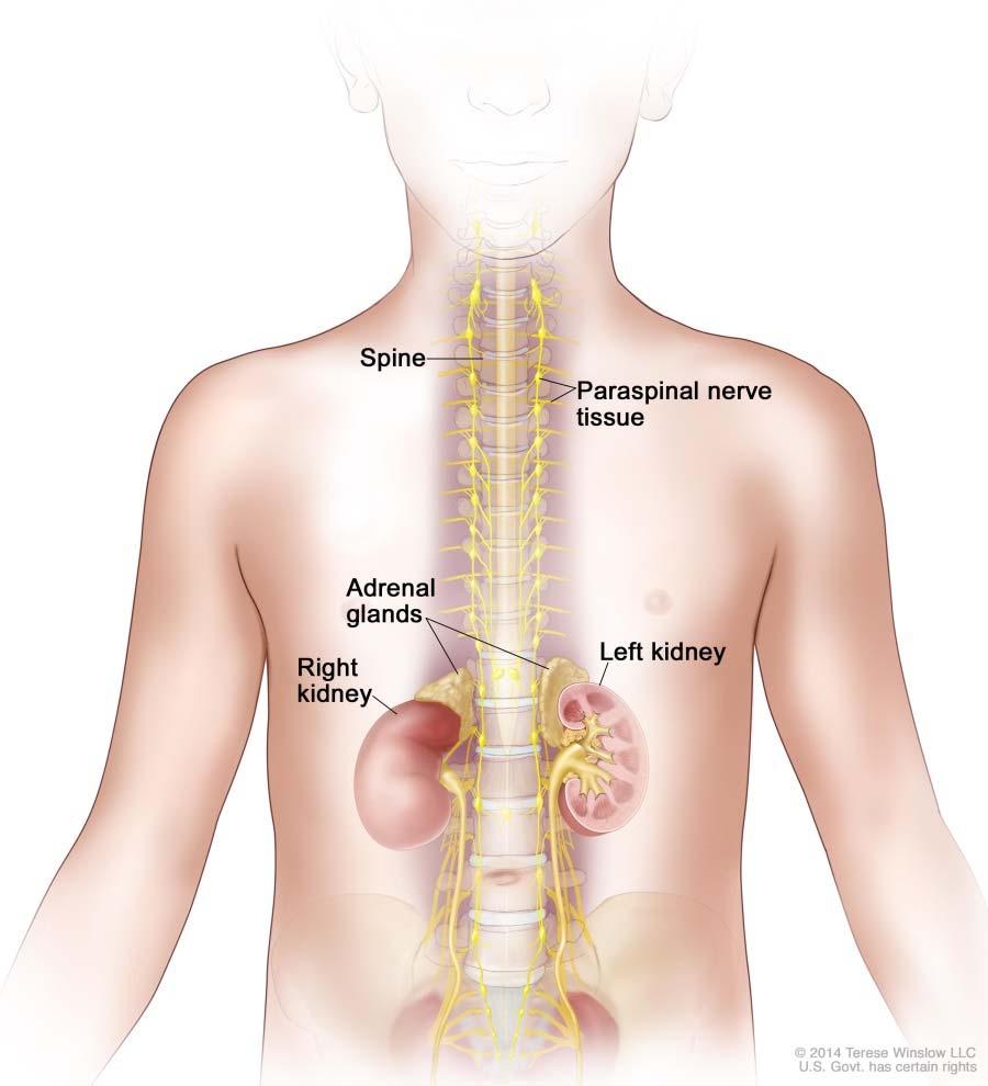Common Neuroblastoma Sites Adrenal
