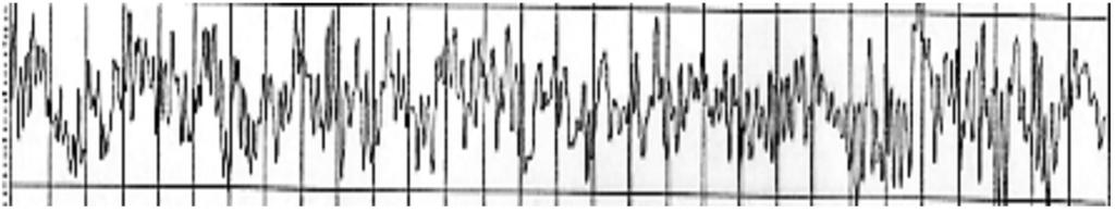 It resembles a slinky on its side and the waveforms are equal inamplitudeandoccurasaspecificfrequency.