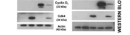 Clonetics Islets and Western Blots Rat Human LacZ LacZ / ckd4 Cyclin D1 / lacz Cdk4 / cyclin D1 Uninfected LacZ LacZ / ckd4 Cyclin D1 / lacz Cdk4 /