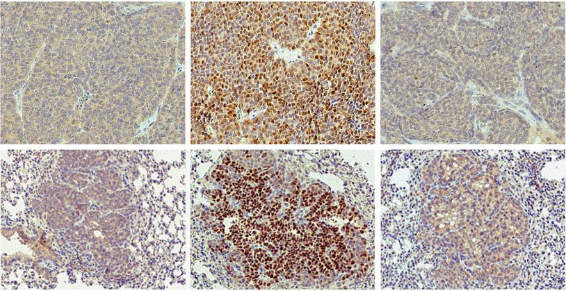 Published online: March 3, 215 The EMBO Journal Shp2 in mammary gland cancer Linxiang Lan et al A Hyperplasia Adenoma Carcinoma B PyMT;Shp2 fl/fl