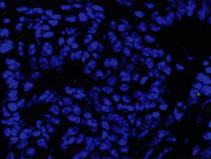 Published online: March 3, 215 Linxiang Lan et al Shp2 in mammary gland cancer The EMBO Journal A PyMT; Shp2 fl/fl