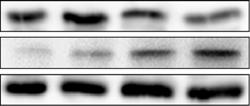 E Western blot analysis of p27, p53, and a-tubulin in PyMT cells treated with control (DMSO) or inhibitors against Skp2 (MLN4924), Aurora A (VX-68), or Notch (DAPT) at the indicated concentrations.