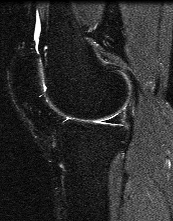 Downloaded from www.ajronline.org by 46.3.25.67 on 12/5/17 from IP address 46.3.25.67. Copyright RRS. For personal use only; all rights reserved Musculoskeletal MRI at 3. T C Fig. 8.