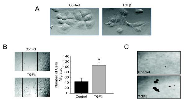 42 2.4.3 TGF -induced EMT results in CSC characteristics During later stages of disease, TGF induces EMT and contributes to disease progression (45, 161) After TGF stimulation; epithelial cells