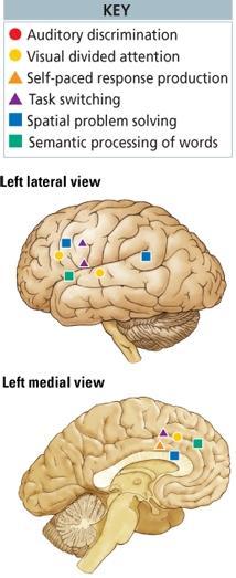 Decrease in blood flow to the frontal lobes, and frontal lobe atrophy