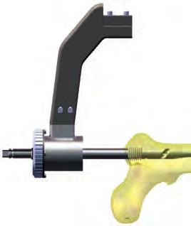 Standard Interlocking Surgical Technique TARGETING DEVICE Step 10 TARGETING