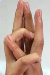 We further divided the FDS-connection into two subtypes according to the extent of flexion of the PIP joint of the adjacent ring finger of the tested hand.