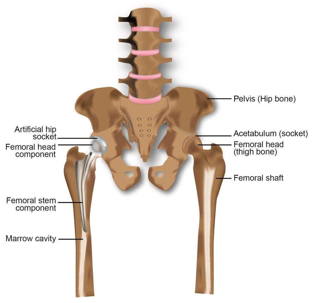 Figure 1-1: Structure of the hip joint Anterior view showing hip structure and its anatomical components.
