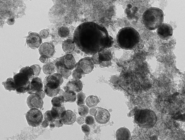 particles alone A: A macrophage displaying characteristics of this cell type lobular nucleus