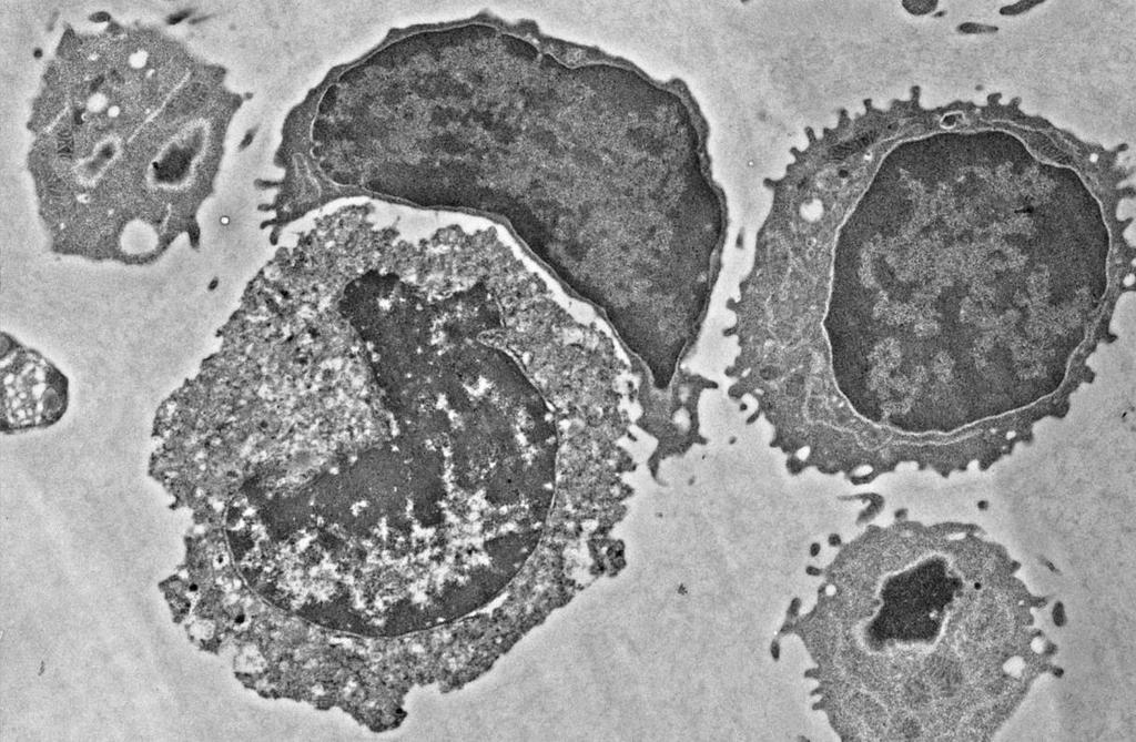Lymphocytes are not affected necrosis apoptosis Figure 5-7: Cell toxicity, necrosis and apoptosis after metal particle exposure Figure is showing a representative image of cells within PBMC