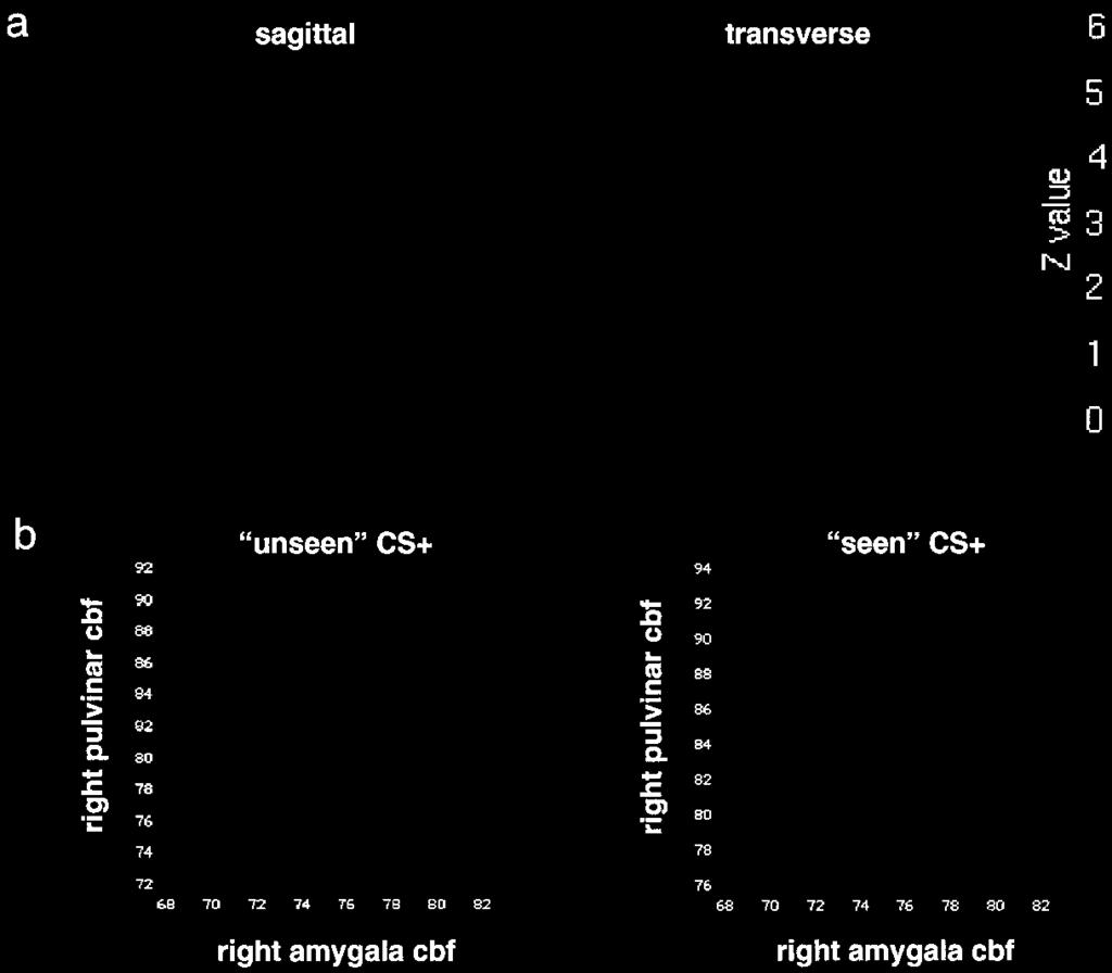 (b) Graphical displays showing bivariate regression plots of right amygdala and right pulvinar activity.