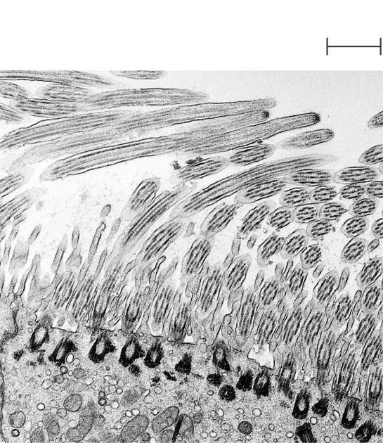 This SEM shows the surface of a cell from a rabbit trachea (windpipe) covered with motile organelles called cilia. Beating of the cilia helps move inhaled debris upward toward the throat.