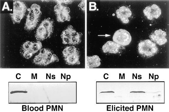 Peters-Golden: Cell Biology of 5-LO Figure 5. Nuclear import of 5-lipoxygenase in elicited rat peritoneal neutrophils.