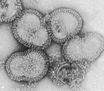 Risk analysis : Influenza (cont d) Source : http://www.nimr.mrc.ac.