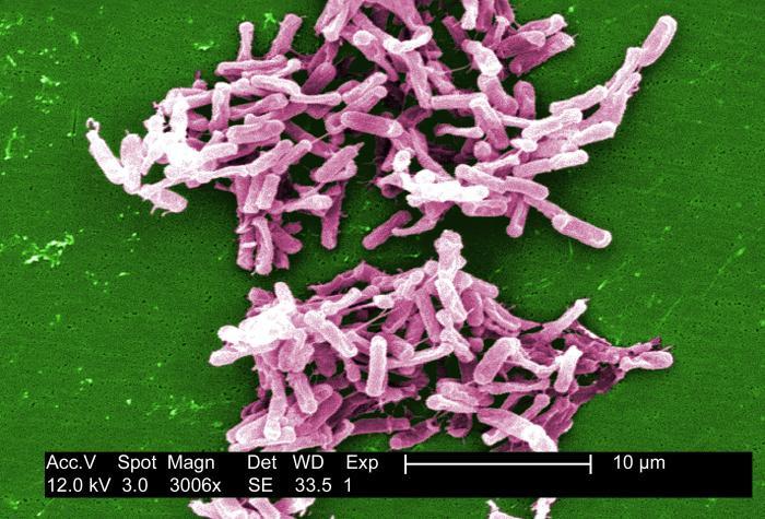 Risk analysis : Clostridium difficile Gram (+) rod, anaerobic Sporulating: spores are very resistant Toxin producer: can cause diarrhea to severe colitis CDC/ Lois S. Wiggs ID#9999 http://phil.cdc.
