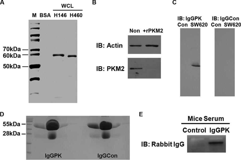 FIGURE 2. Antibody against PKM2 specifically recognizes PKM2. A, immunoblot of PKM2 in the whole cell lysate (WCL) of H146 and H460 cells using the anti-serum of the antibody PabPKM2.